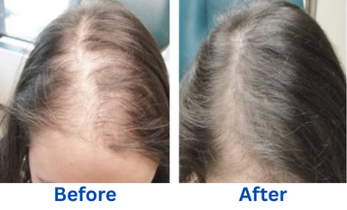 Revifol Benefits